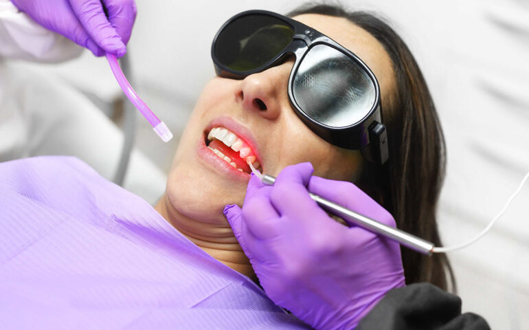 Laser Gum Treatment in Ahmedabad