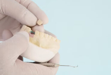 Wisdom Tooth Removal