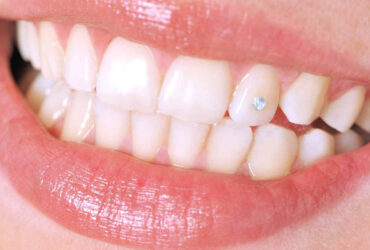 Teeth Jewellery