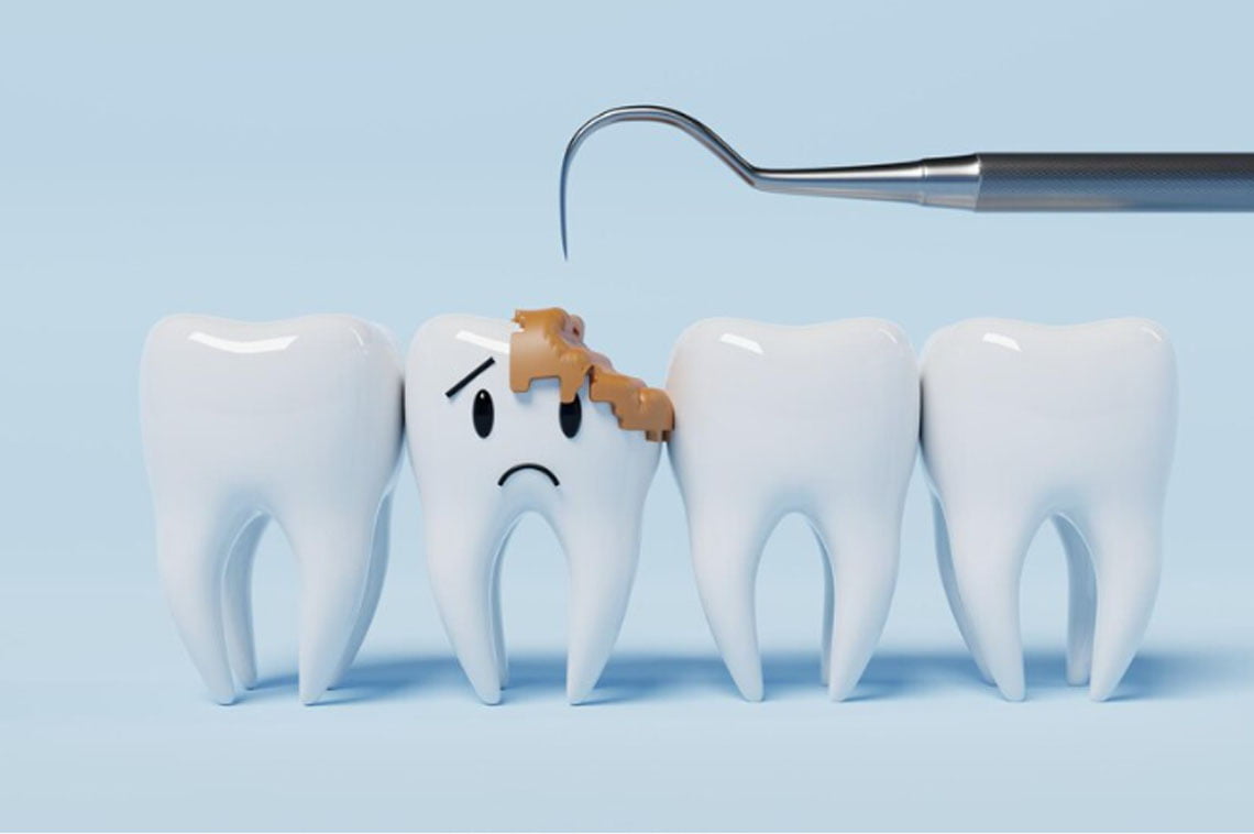 Always thinking How can you prevent dental problems of your child and your family?