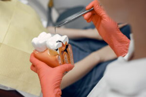 What is root canal treatment?