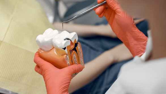 What is root canal treatment?