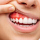 Healthy Teeth & Gums Contribute Significantly to an Overall Healthy Lifestyle in Several Ways