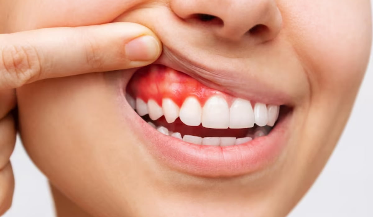 Healthy Teeth & Gums Contribute Significantly to an Overall Healthy Lifestyle in Several Ways