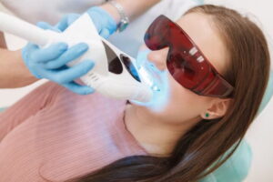 Precision, Care, and Radiance: NOVA Dental Hospital Introduces Laser Teeth Whitening with Minimal Discomfort