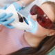Precision, Care, and Radiance: NOVA Dental Hospital Introduces Laser Teeth Whitening with Minimal Discomfort