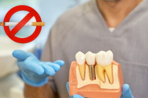 Why Smoking is a Contraindication for Implant Patients – A Closer Look at Oral Health Risks