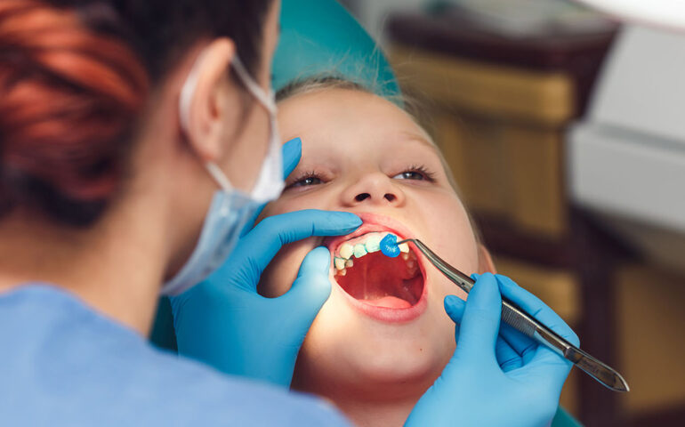 Child Dental Treatment