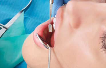 Dental Conservative Treatment