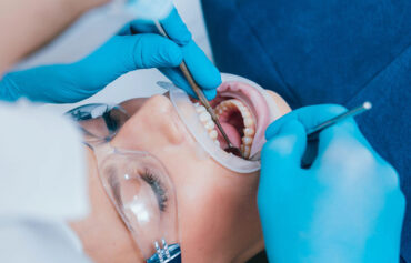 Oral Surgery