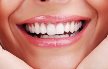 Smile Analysis and Smile Design