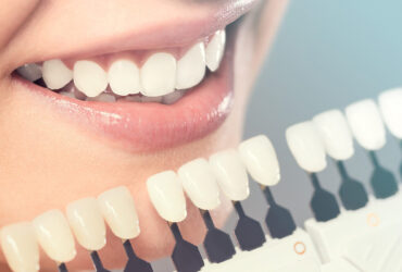 Cosmetic Dentistry